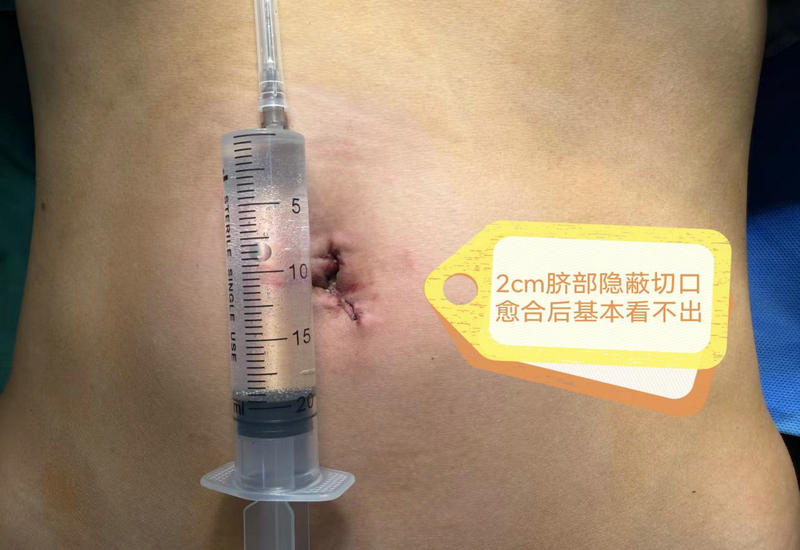 ����Э������˶����������������ҽԺ�ɹ���չ�������׸�ǻ���¾���������λ������